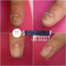 라온네일클리닉안양