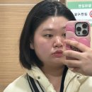 [신사 에스테틱] 에스로이 에스테틱 카카오톡 이벤트 당첨 후기! (솔직 후기)