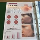 청담동 피부과 눈가주름 관리 리즈네힐러 스킨부스터 솔직후기