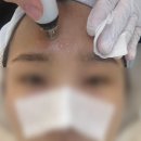 필아쿠아 | 세종 피부관리샵 에스테틱 핸즈온유 아쿠아필 후기