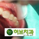 구리허브치과 티스토리