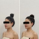 오룸스킨 | 울산피부관리 / 삼산동에스테틱 "아뜰리에드스킨" 4D 카밍리프팅 2회차 후기