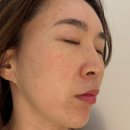 장산역 피부관리 모어스킨 수분관리 후기