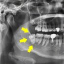 동탄가온치과의원 이미지