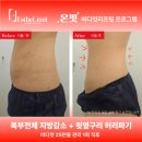 다이어트, 출산 후 처진 뱃살 관리 어떻게 해야 할까요? 송도 에스테틱 온핏 리프팅 후기와 6월 이벤트
