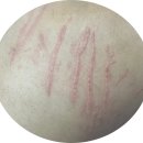 스킨52부천지부 이미지