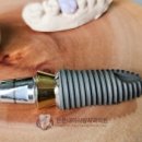 튼튼내이사랑치과의원 이미지