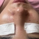 로운에스테틱