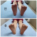 수기자연체형관리(주간) | 인천 미추홀구 체형관리 전방십자인대파열 후 찾은 [엘림통증수기관리 체형교정센터]