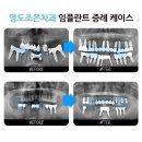 조은플란트치과 이미지