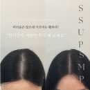 💙♥️썹에스엠피 두피문신샵을 선택해야 하는 이유♥️💙 위례두피문신 위례헤어라인반영구