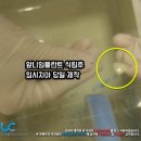 충경치과의원 | 앞니임플란트 식립후 임시치아(Temporary Crown) 당일제작 가능?