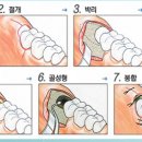 첫사랑니치과의원 이미지