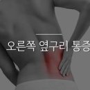 왼쪽 옆구리 통증(오른쪽) 원인 은? 이미지