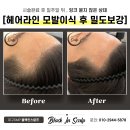 블랙인스칼프 이미지