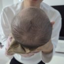 기임빌딩 | [육아기록] 두상교정 | 강북삼성병원 진료 그리고 두상헬멧 계약 후기(업체: 지오헬멧)