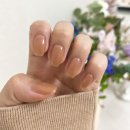 고위험 산모 출산 후기｜성장지연으로 조산, 제왕절개, NICU 입원한 미숙아