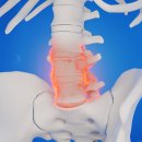 요추 4~5번 가장 많은 부담을 받는 부위, 허리펴기 운동을 하세요~ 이미지