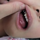 샘물소아치과의원 | 장호원치과 서울우수한치과의원 소아충치 진료후기