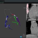 코어소프트 이미지