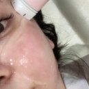 합정피부과 핫썸머 핫이벤트! 7월 볼뉴머+슈링크(볼링크) 프로모션 ♥