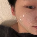 피부시술 후 재생관리 잘짜여진 프로그램 채움에스테틱 다녀온 후기