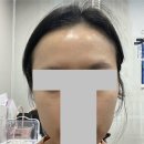 대신당건재약품 | [쥬베룩스X써마지FLX] 쥬베룩이랑 써마지 FLX 같이 맞은 썰 풀어본다