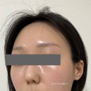 교아 에스테틱 | 방배동 교아 에스테틱 : 초민감성 피부가 대만족한 내돈낸산 찐후기, 비포애프터 있음