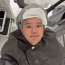 제주스팀닥터 | 슬프지만 탈모 초기였습니다… 닥터포헤어 제주점에서 진단받은 결과