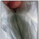 이뉴 | 이뉴바 마스크팩 후기｜턱라인까지 쫀쫀하게 당겨준 리프팅 홈케어