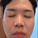 쎄리스킨케어 | 달바 올쎄라더블샷 2주 사용 후기