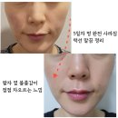 서초대로 271 | 서초동피부관리 바오뜨에스테틱에서 경험한 탄력관리 원모드 멍, 애프터 후기