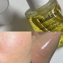 비타의원 | 2주 솔직 후기) 바이오던스 래디언트 비타 나이아신아마이드 세럼 사용 기록 (2)