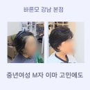 50대 중년 여성 M자 이마 고민, 앞머리 부분가발 하나로 두상 볼륨까지 완벽 해결한 후기