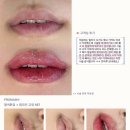 프롬메이 | 인천입술문신 추천! 자연스러운 혈색 톤업과 비대칭 교정 후기 / 프롬메이