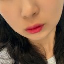 (주)연제 | 부산 연제구 피부과 입술필러 맞고 온 후기