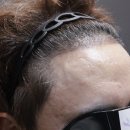 압구정모비앙의원 이미지