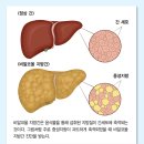 간수치 이걸 믿어 말어 이미지