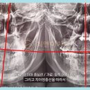 최앤이치과의원