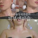 5265 | 군산 수송동 피부관리 피부엔이슬 온다리프팅 리얼후기 (웨딩관리로 굿!)