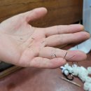 건강 지킴이 수지침 이미지