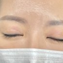 로브레아