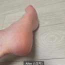 마가렛20 | 발각질제거 마가렛SOS 풋크림 추천 후기: 풋크림 정착템