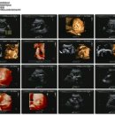 하이힐다이어트(케이엔티상사) | [W28] 입체초음파 / 우리 꼬막이는 누구를 닮았을까 / 28주 배크기 변화 / 직장 예비맘의 투덜 투덜