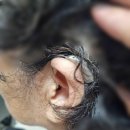 푸른소리 보청기 이미지