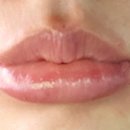 에르샤몽 연세강남의원 이미지