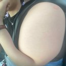 구완서내과의원 | 느슨해진 잔여백신창에 우주먼지의 등장이라..