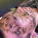 에띠민에스테틱 | 남양읍피부관리 잘하는곳, “에띠민에스테틱”에서 트러블관리 4회차 후기