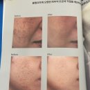 한설에스테틱 | 천안불당] 피부관리 찐고수 어디? _한설에스테틱에서 만난 피부진단