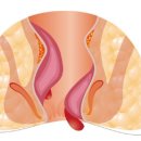 상쾌한 항구병원 이미지